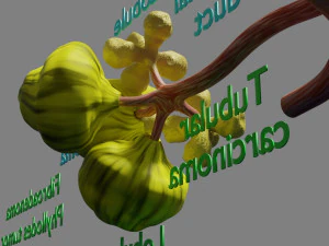 Breast duct sites and diseases 3D Model