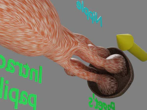 Breast duct sites and diseases 3D Model
