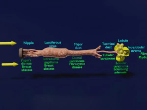 Breast duct sites and diseases 3D Model