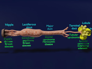 Breast duct sites and diseases 3D Модель