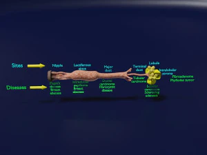 Breast duct sites and diseases 3D Model