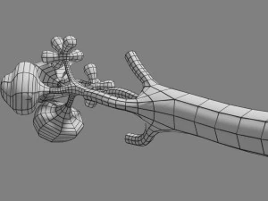 Breast duct sites and diseases 3D Model