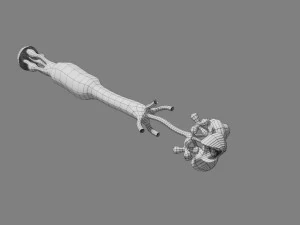 Breast duct sites and diseases 3D Model