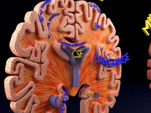 Alzheimer Disease Brain coronal slice 3D Model