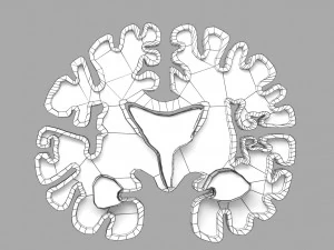 Alzheimer Disease Brain coronal slice 3D Model