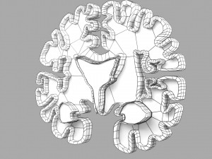 Alzheimer Disease Brain coronal slice 3D Model