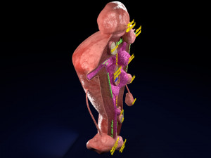 Fibroid Uterus Human female 3D 3D मॉडल
