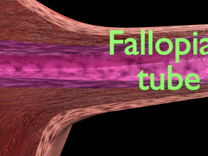 Fibroid Uterus Human female 3D 3D मॉडल