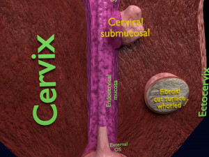 Fibroid Uterus Human female 3D 3D मॉडल