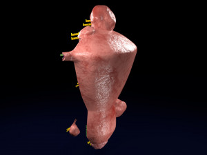 Fibroid Uterus Human female 3D 3D मॉडल