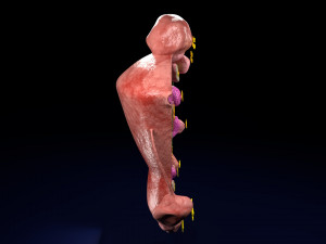 Fibroid Uterus Human female 3D 3D मॉडल