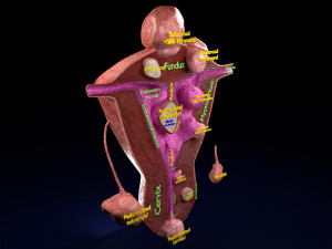 Fibroid Uterus Human female 3D 3D मॉडल