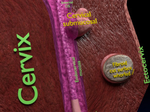 Fibroid Uterus Human female 3D 3D मॉडल