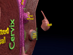 Fibroid Uterus Human female 3D 3D मॉडल