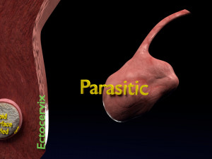Fibroid Uterus Human female 3D 3D मॉडल