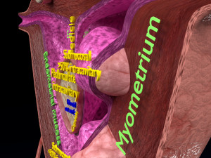 Fibroid Uterus Human female 3D 3D मॉडल