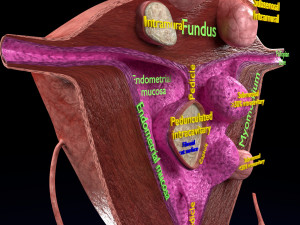 Fibroid Uterus Human female 3D 3D मॉडल