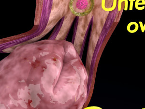 Fertilization stages of ovum 3D मॉडल
