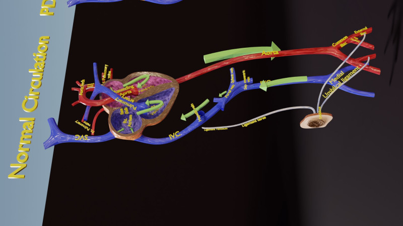 PDA Patent Ductus Arteriosus vs Normal blood circulation 3D Model .c4d .max .obj .3ds .fbx .stl .blend 