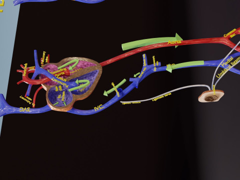 PDA Patent Ductus Arteriosus vs Normal blood circulation 3D Model