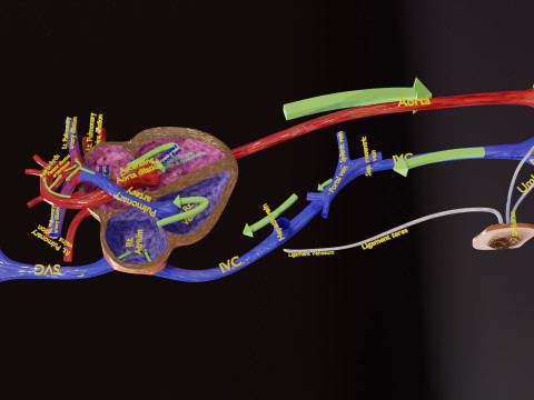 PDA Patent Ductus Arteriosus vs Normal blood circulation 3D Model