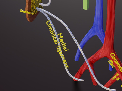 PDA Patent Ductus Arteriosus vs Normal blood circulation 3D Model