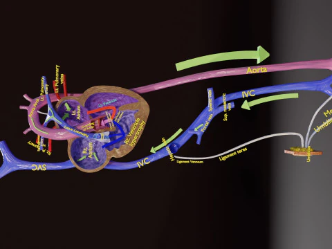 TAF Tetralogy of Fallot vs Normal circulation 3D Model