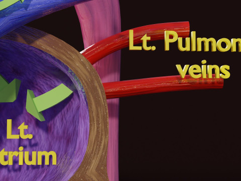 TAF Tetralogy of Fallot vs Normal circulation 3D मॉडल