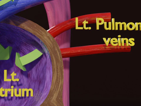 TAF Tetralogy of Fallot vs Normal circulation 3D Model