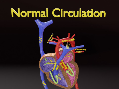 TAF Tetralogy of Fallot vs Normal circulation 3D मॉडल