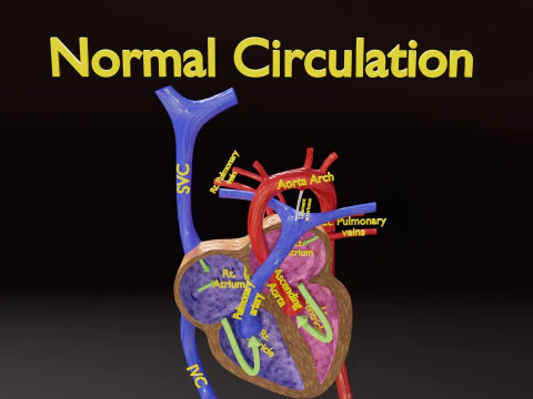 TAF Tetralogy of Fallot vs Normal circulation 3D Model