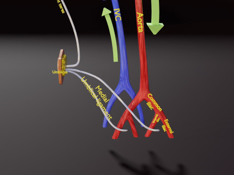 TAF Tetralogy of Fallot vs Normal circulation 3D मॉडल