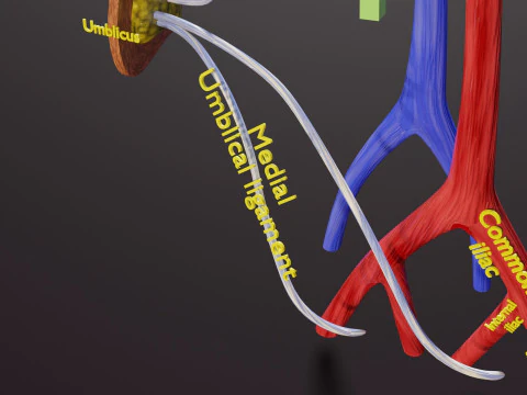 TAF Tetralogy of Fallot vs Normal circulation 3D Model