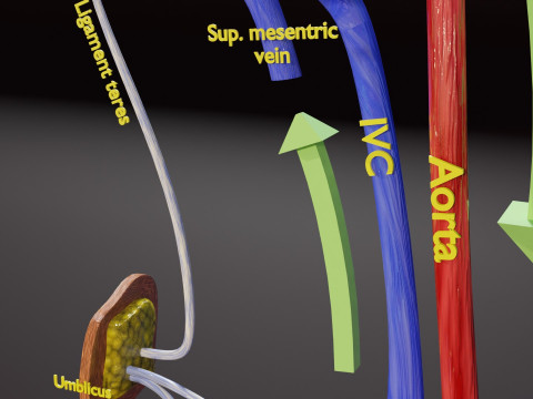 TAF Tetralogy of Fallot vs Normal circulation 3D मॉडल