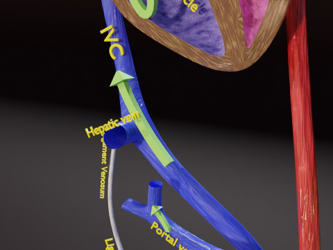 TAF Tetralogy of Fallot vs Normal circulation 3D मॉडल