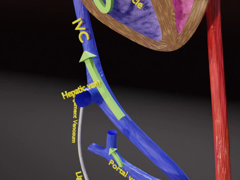 TAF Tetralogy of Fallot vs Normal circulation 3D Model