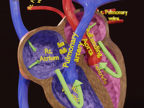 TAF Tetralogy of Fallot vs Normal circulation 3D Model