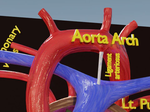 TAF Tetralogy of Fallot vs Normal circulation 3D Model