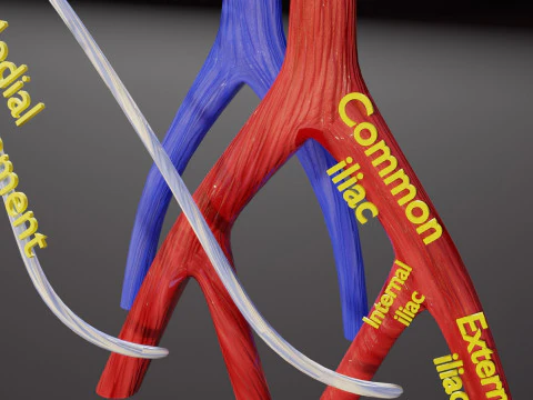 TAF Tetralogy of Fallot vs Normal circulation 3D Model