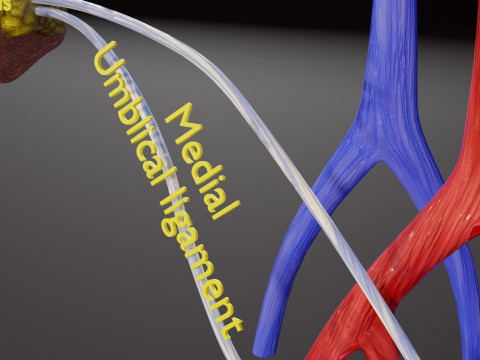 TAF Tetralogy of Fallot vs Normal circulation 3D मॉडल