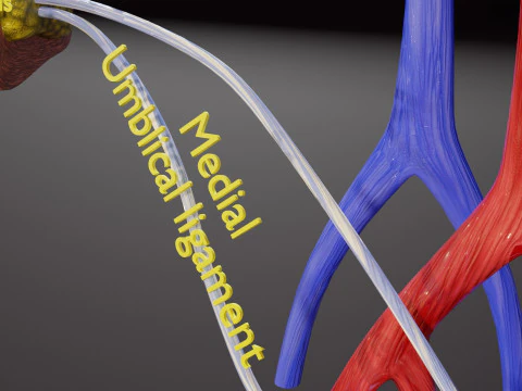 TAF Tetralogy of Fallot vs Normal circulation 3D Model