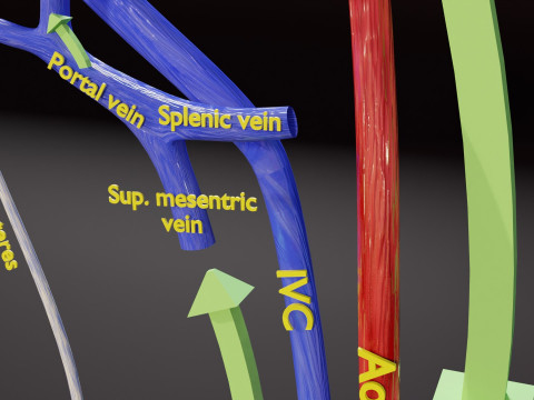 TAF Tetralogy of Fallot vs Normal circulation 3D मॉडल