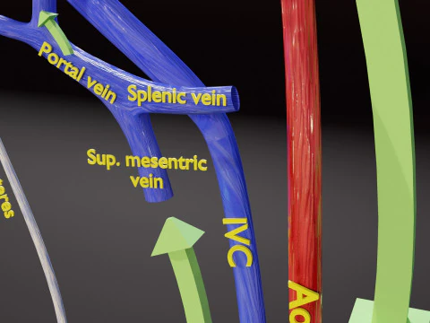 TAF Tetralogy of Fallot vs Normal circulation 3D Model