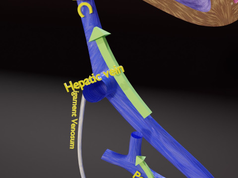 TAF Tetralogy of Fallot vs Normal circulation 3D मॉडल