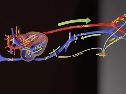 TAF Tetralogy of Fallot vs Normal circulation 3D Model