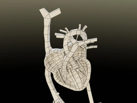 TAF Tetralogy of Fallot vs Normal circulation 3D Model