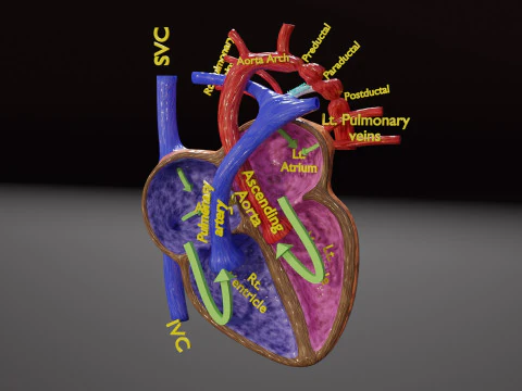 COA Coartaci&oacute;n de Aorta Modelo 3D