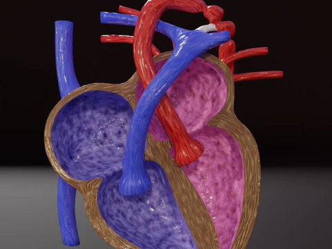 COA Coartaci&oacute;n de Aorta Modelo 3D