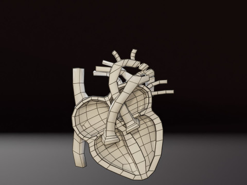 COA Coarctation of Aorta 3D Model