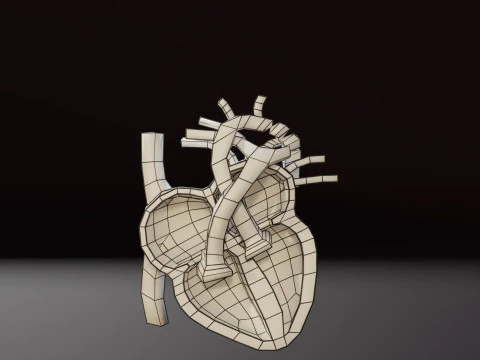 COA Coartaci&oacute;n de Aorta Modelo 3D
